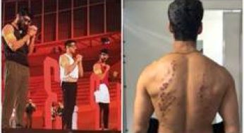 KKK 15: After Gaurav Khanna, Karan Wahi shares injury marks from 'rubber bullet' challenge, calls season "scariest"